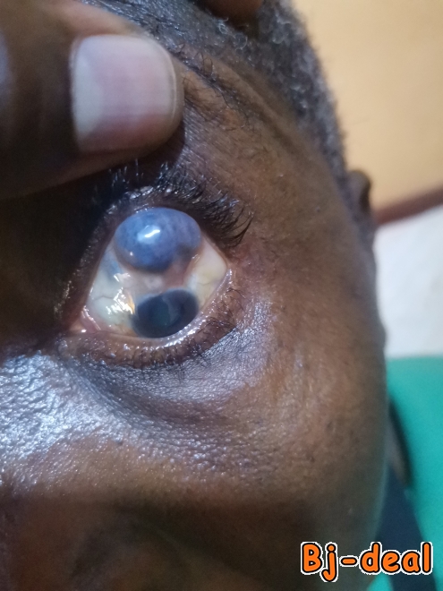 Image principale de TECHNICIEN SUPERIEUR EN OPHTALMOLOGIE