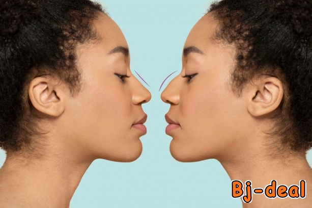 Image principale de Mettez fin à vos petites imperfections