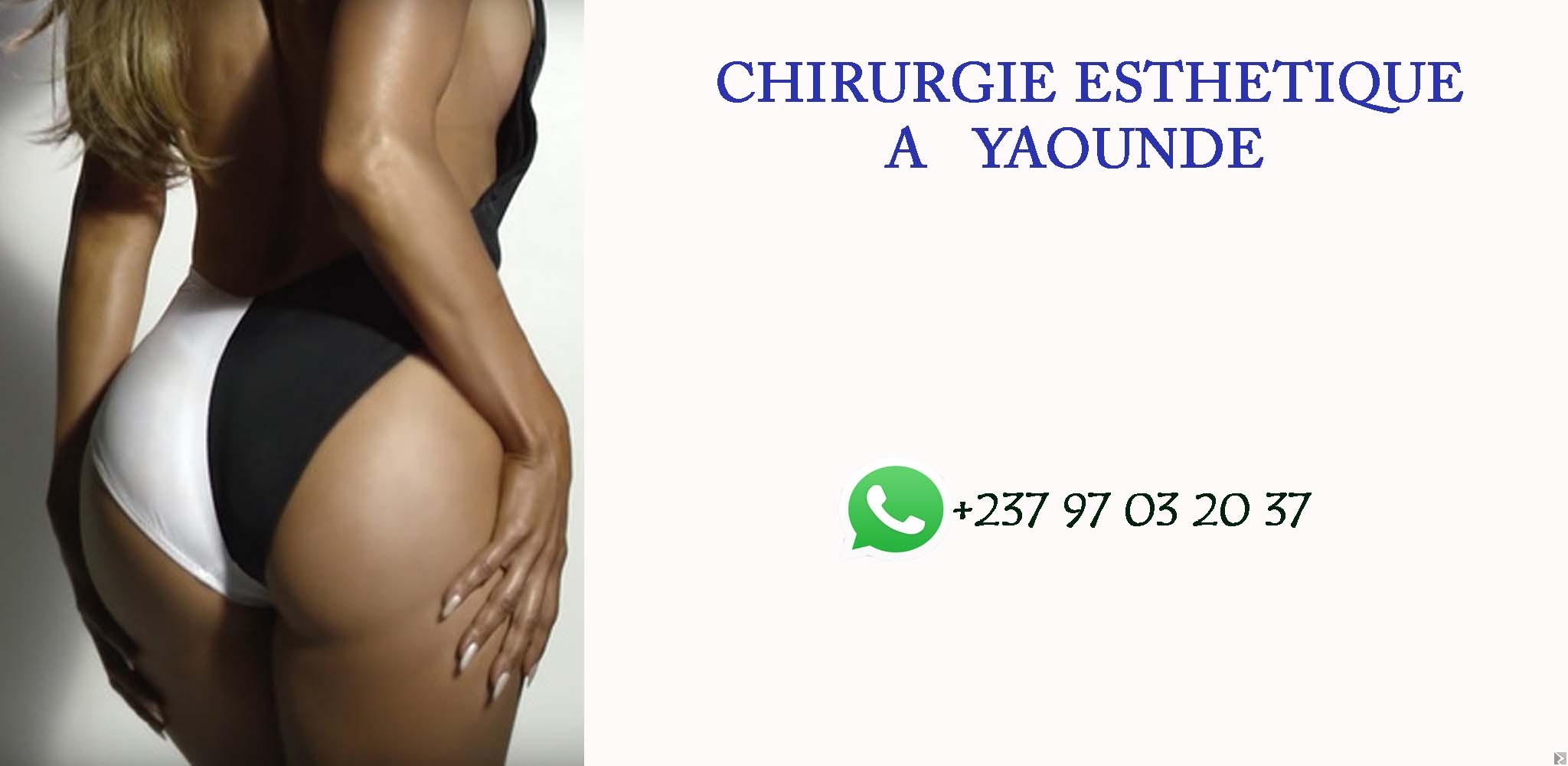 Image principale de chirurgie esthétique au Cameroun