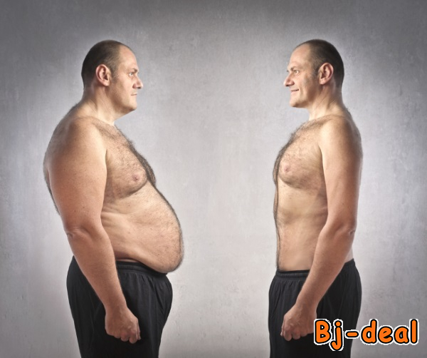 Image principale de BY-PASS GASTRIQUE DOUALA