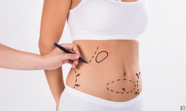 Image principale de LIPOSUCCION A YAOUNDE