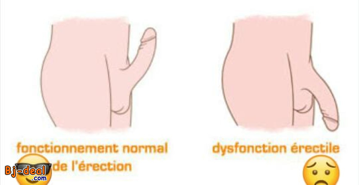 Main image of BOIS BANDÉ PUISSANT NATURELLEMENT
