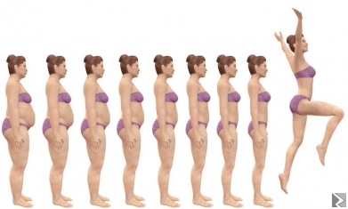 Main image of Bypass gastrique