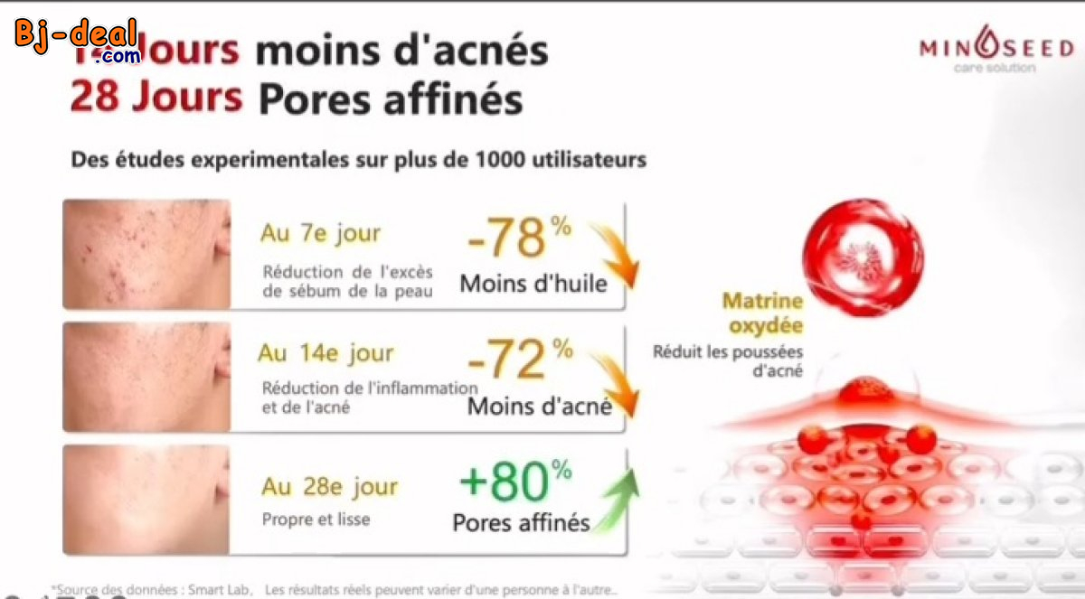 Image principale de SAVON MINOSEED  AU GINSENG ET AUX PARTICULES DE FEUILLES D’OR LUXUEUSES....DOUALA