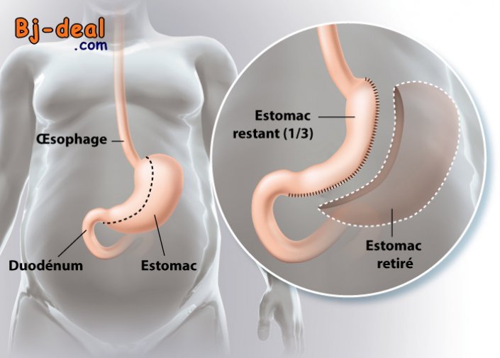 Main image of Et si vous disiez adieu aux kilos en trop sans passer par des régimes