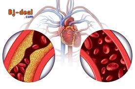 Main image of Hypertension Reprenez le contrôle de votre vie avec Virtual Clinic