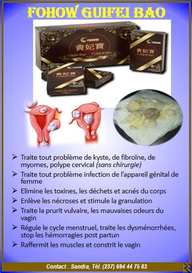Image principale de Chocolat des femmes FOHOW