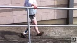 Image principale de Prothèse de la jambe après amputation