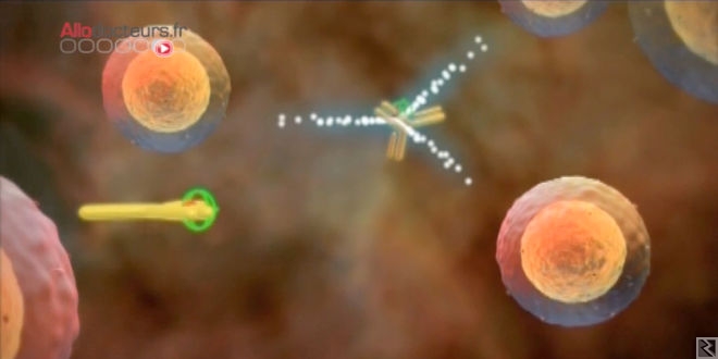 Image principale de Traitement chirurgie du cancer et chimiothérapie