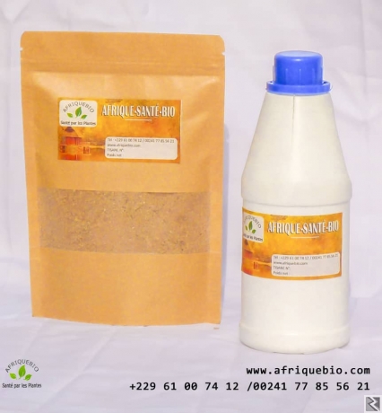 Main image of Infertilité féminine