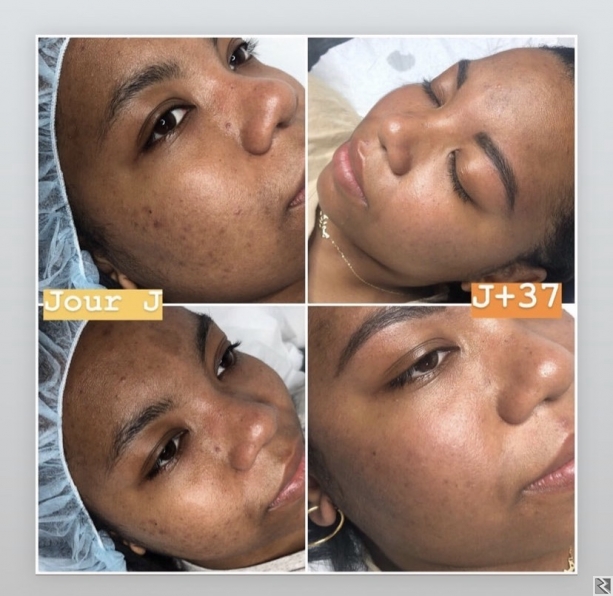 Main image of PEELING DU VISAGE