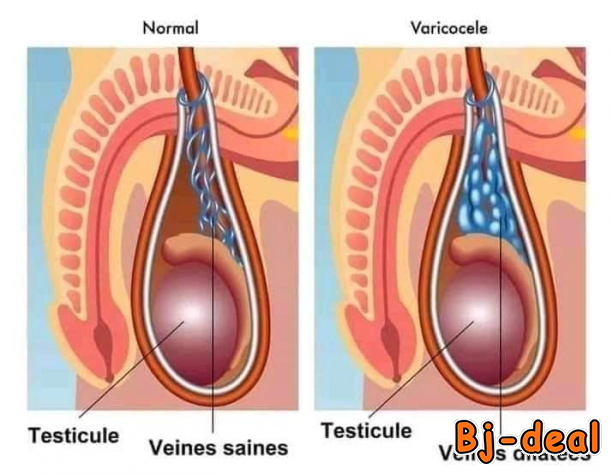 Image principale de Varivax plus forte