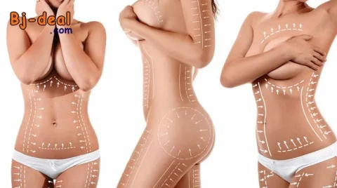 Image principale — Liposuccion Chirurgie Esthétique au Cameroun
