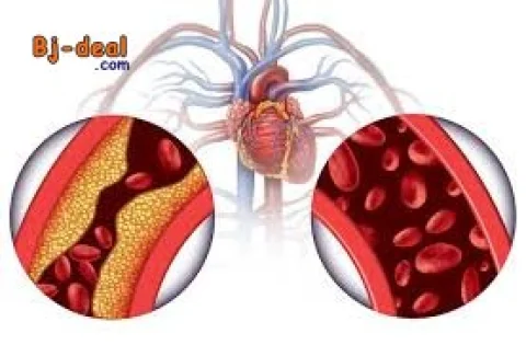 Main image — Hypertension Reprenez le contrôle de votre vie avec Virtual Clinic